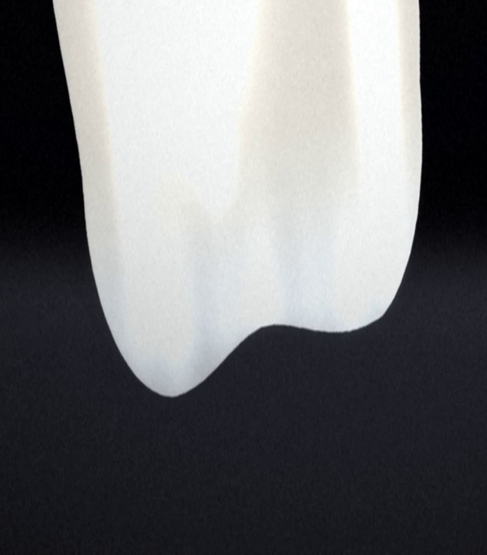 incisal edge crop